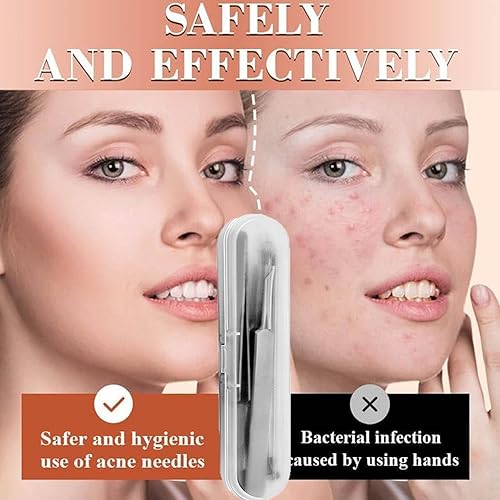 Miniatura 6 de Kit de eliminación de puntos negros de acero inoxidable, kit de herramientas para reventar espinillas, pinzas removedoras de puntos negros,