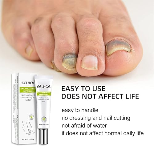 Miniatura 4 de Crema para reparación de uñas, crema para reparación de uñas, restaura la apariencia de uñas desnudas o dañadas, crema de belleza instantánea para