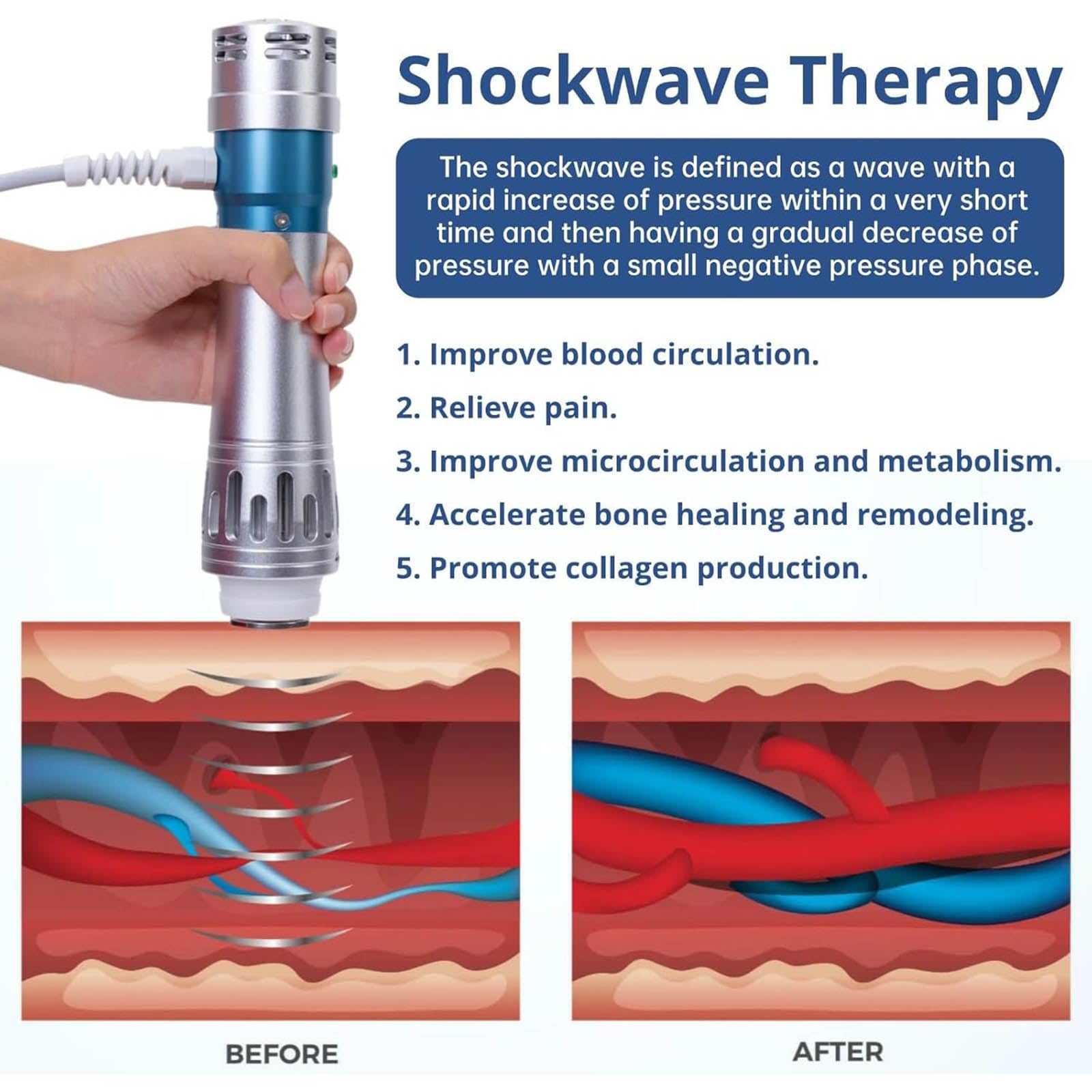 Apparecchio portatile per terapia ad onde d'urto - Dispositivo per terapia ad onde d'urto elettromagnetiche, per il sollievo dal dolore e il rilassamento muscolare,Natural