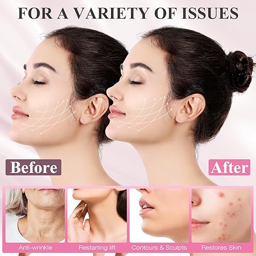 Miniatura 4 de Correa de barbilla para dormir, reductor de barbilla doble, correa de barbilla ajustable, correa de mandíbula, moldeador de mandíbula, máscara de