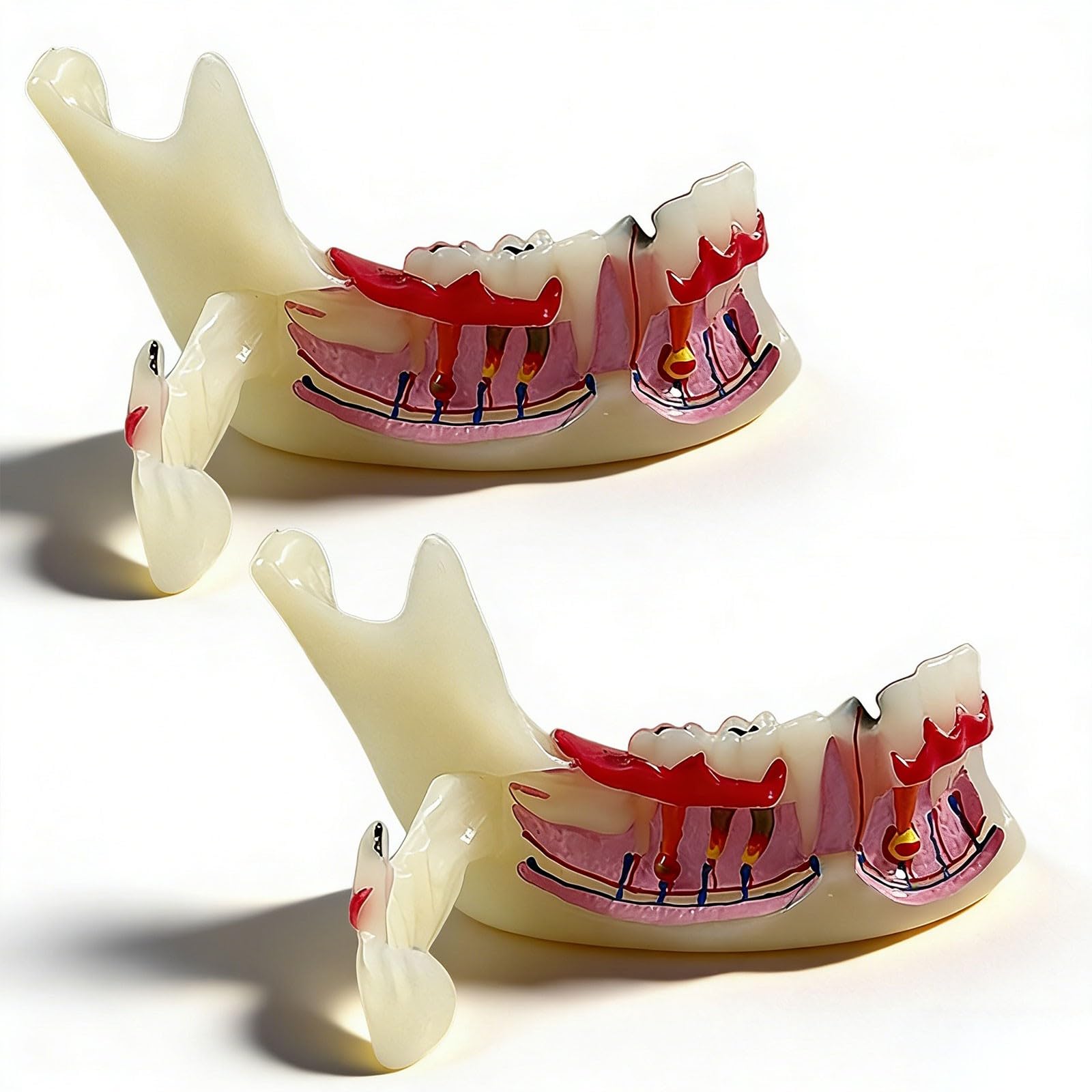 Modello di denti Typodont per l'educazione orale, strumento dimostrativo per lo studio della carie e della cisti radicale, aiuto didattico anatomico per dentisti