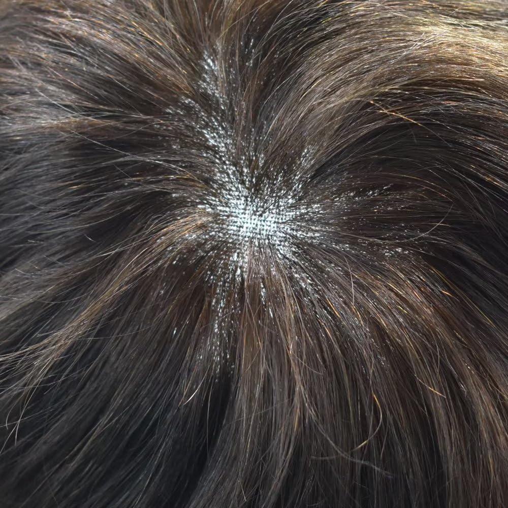 FACE MIRACLE Full French Lace Mens Toupee Human Hair Replacement Systems Toupee for Men All Lace Hairpieces for Man Natural Hairline Mens Wig 7"*9",320#