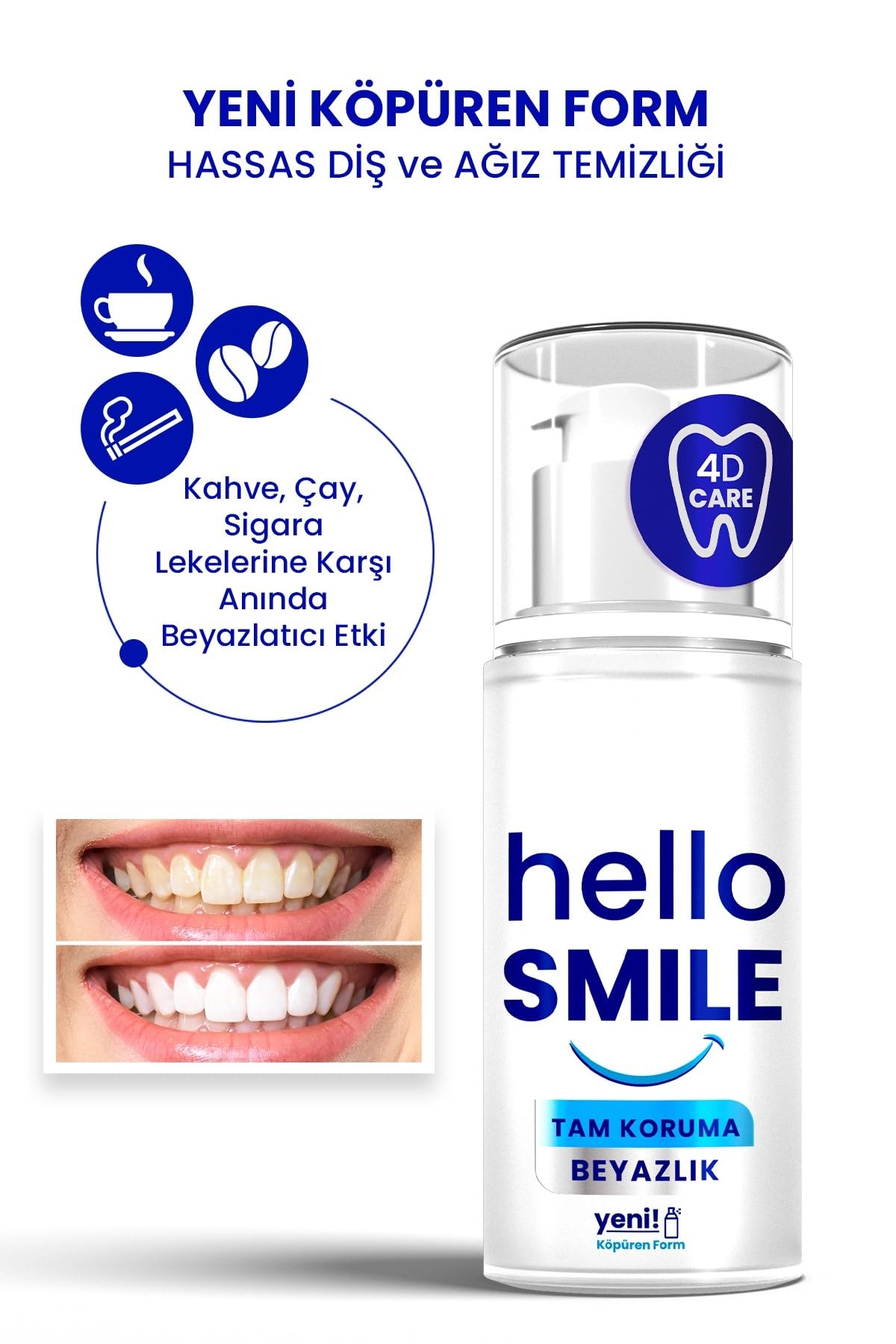 HELLO SMILE Tam Koruma Anında Beyazlatıcı Diş Jeli 50 ML (4 paketi)