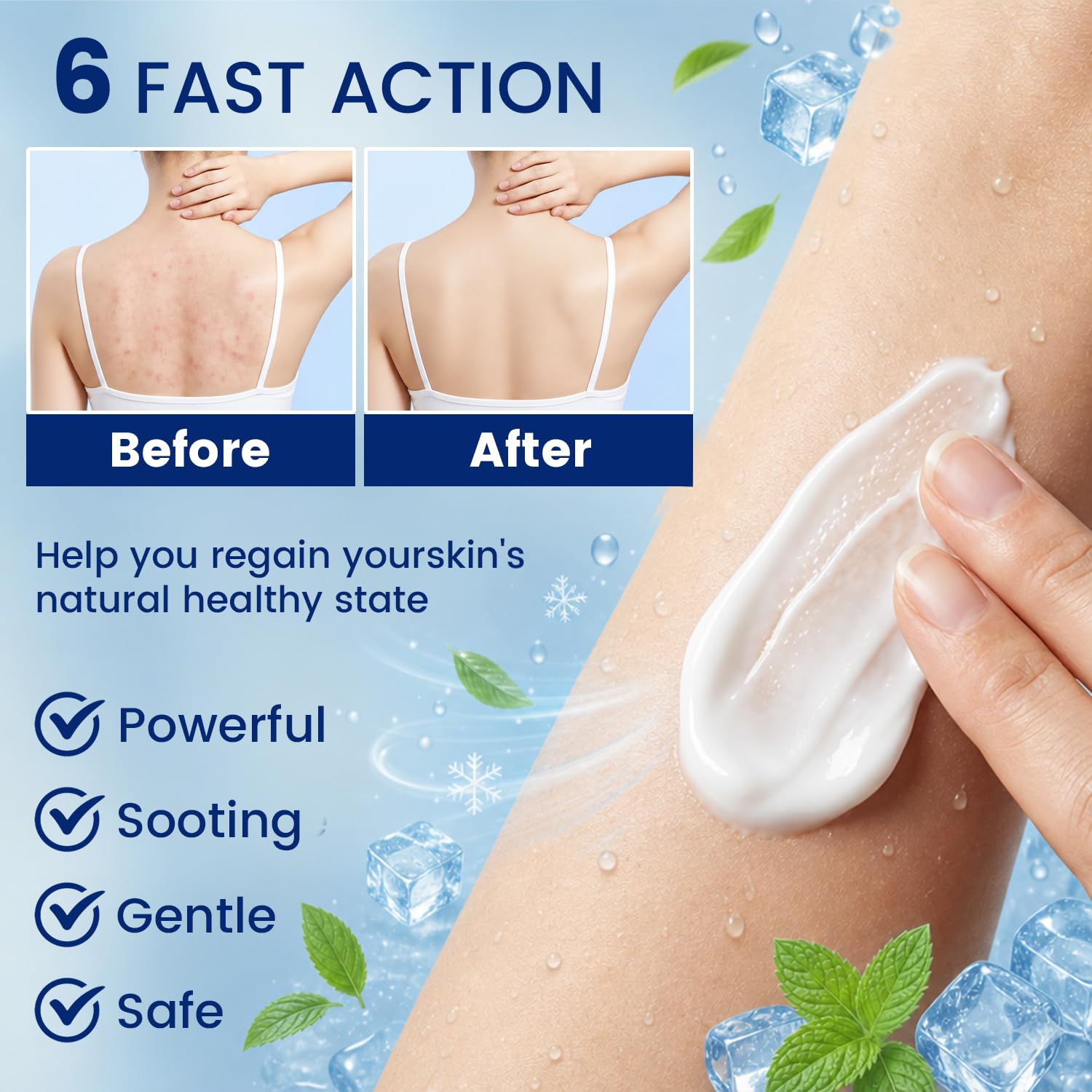 Folliculitis Cream, for Scalp, Face & Body, Moisturizing Skin Care Formula for Folliculitis-Prone Skin, Daily Care for Ingrown Hair, Razor Bumps & Post-Shave Areas, 100g