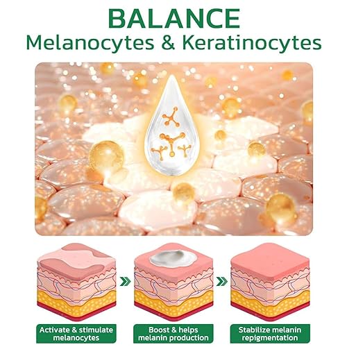 Miniatura 5 de Vitiligo Fix Revitalize Elixir,2023 Nueva crema de tratamiento de vitiligo,Crema calmante para vitiligo,Crema hidratante para el vitíligo de la