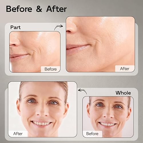 Miniatura 2 de Suero de retinol para cara, antienvejecimiento y antiarrugas, suero de retinol B5 con niacinamida, colágeno y ácido hialurónico, suaviza las arrugas