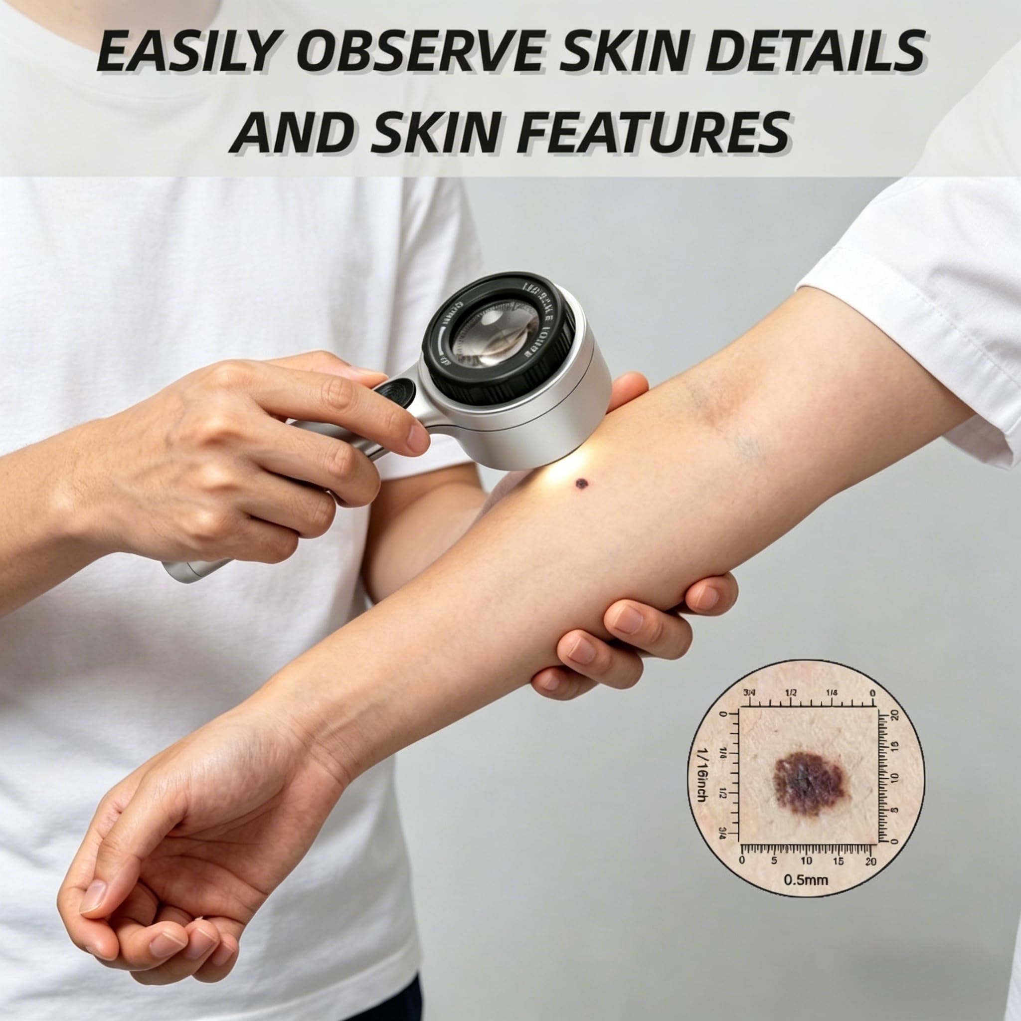 Dermatoscopio portatile, 4 modalità di illuminazione e lente ad alta chiarezza per la pelle, ricaricabile con ingrandimento 30x, dermatoscopio tascabile
