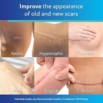 ScarAway Advanced Clear Silicone Scar Sheets, Medical Grade Silicone Strips (1.5 x 3) Scar Treatment and Prevention for Surgical, Burn, Body, Hypertrophic & Keloid Scar Treatment, 6 Clear Sheets