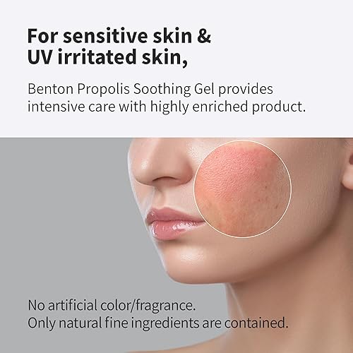 Miniatura 2 de BENTON Gel calmante de aloe propóleos de 3.38 onzas líquidas  Gel de aloe vera para aliviar quemaduras solares  Gel de aloe vera para tamaño de
