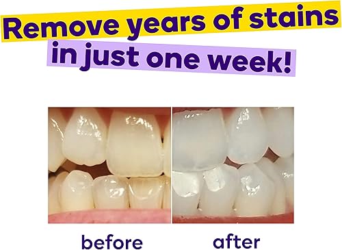 Miniatura 3 de BURST Tiras blanqueadoras dentales con aceite de coco calmante para sensibilidad, suaves con las encías, eliminación profunda de manchas, seguro