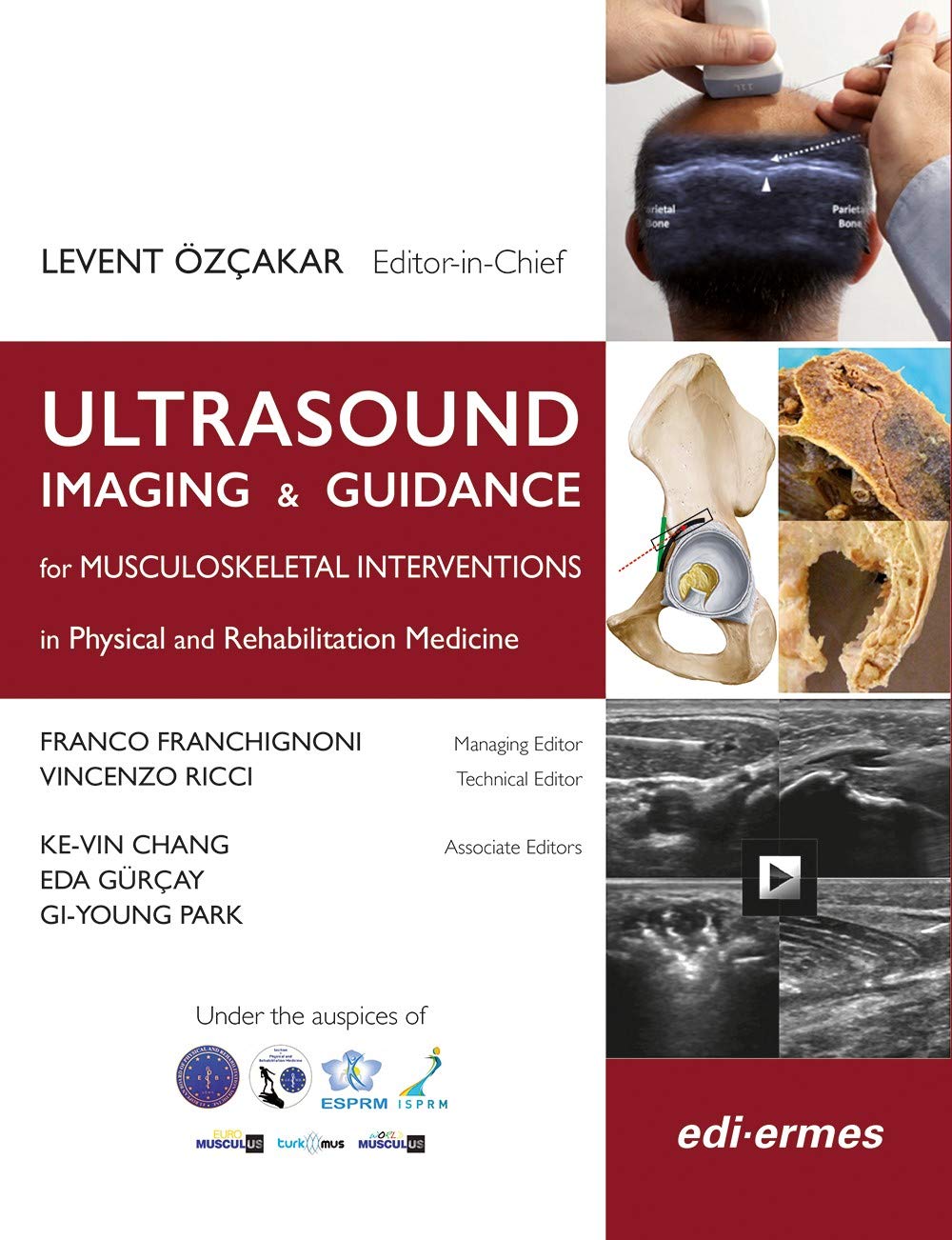 Ultrasound Imaging & Guidance