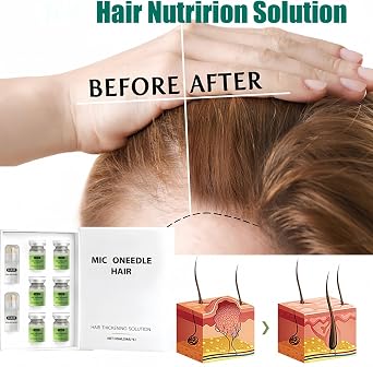Hair Regrowth System,Mic/ro Inf/usion Hair Growth Kit,Hair Thickening System For Damaged Hair with Light Thinning,Keratin Hair Treatment & Growth Oil Serum,Enhances Thick Hairs for Men Women