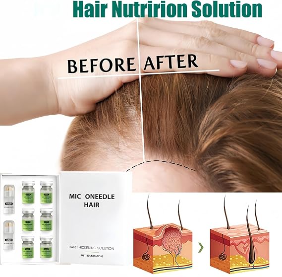 Hair Regrowth System,Mic/ro Inf/usion Hair Growth Kit,Hair Thickening System For Damaged Hair with Light Thinning,Keratin Hair Treatment & Growth Oil Serum,Enhances Thick Hairs for Men Women