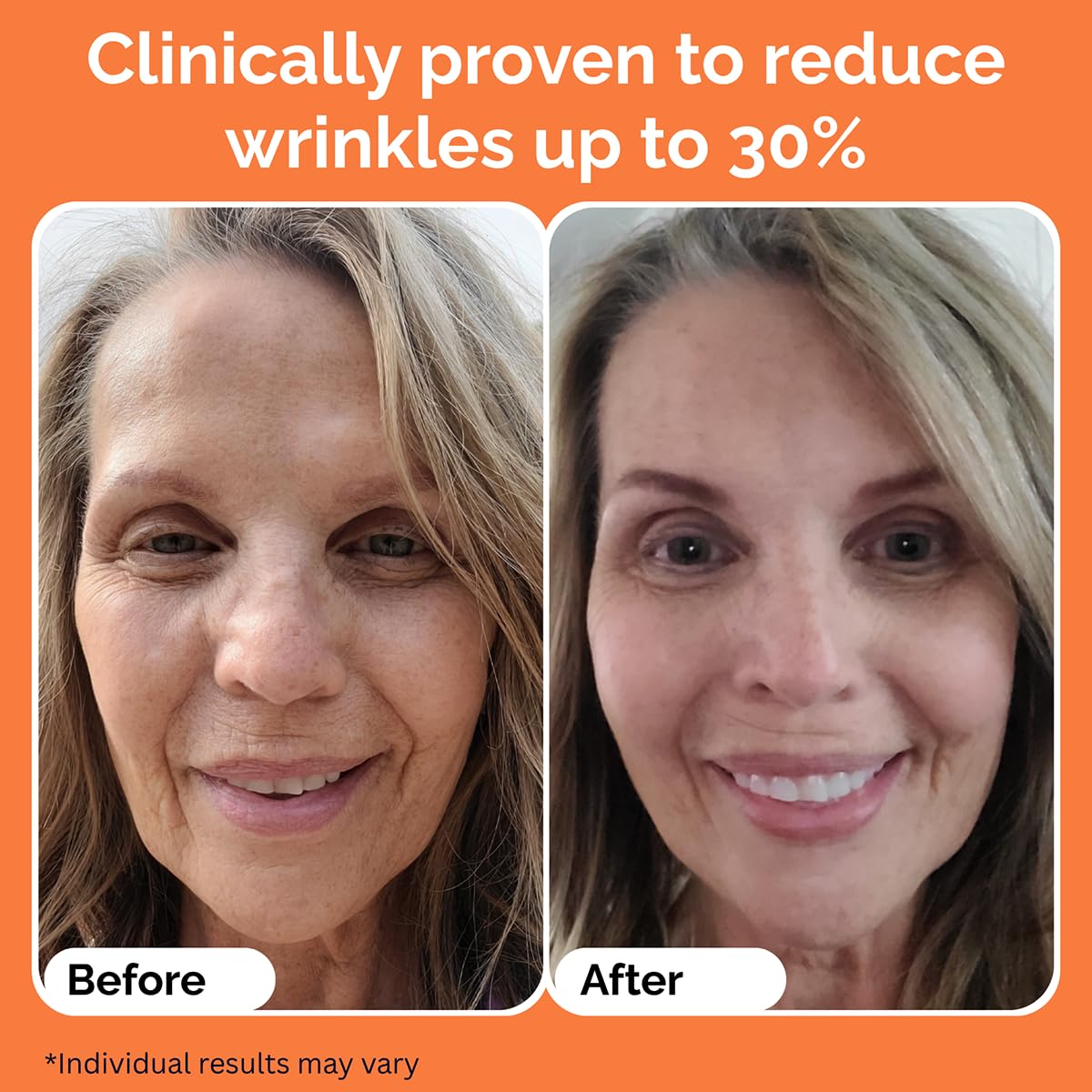Noche Y Dia Vitamin C Serum for Mature Skin - Made in Spain - Anti Aging Formula Hydrates, Moisturizes, Firms - Targets Sun Spots, Fine Lines, Wrinkles - 30mL (1 fl oz)