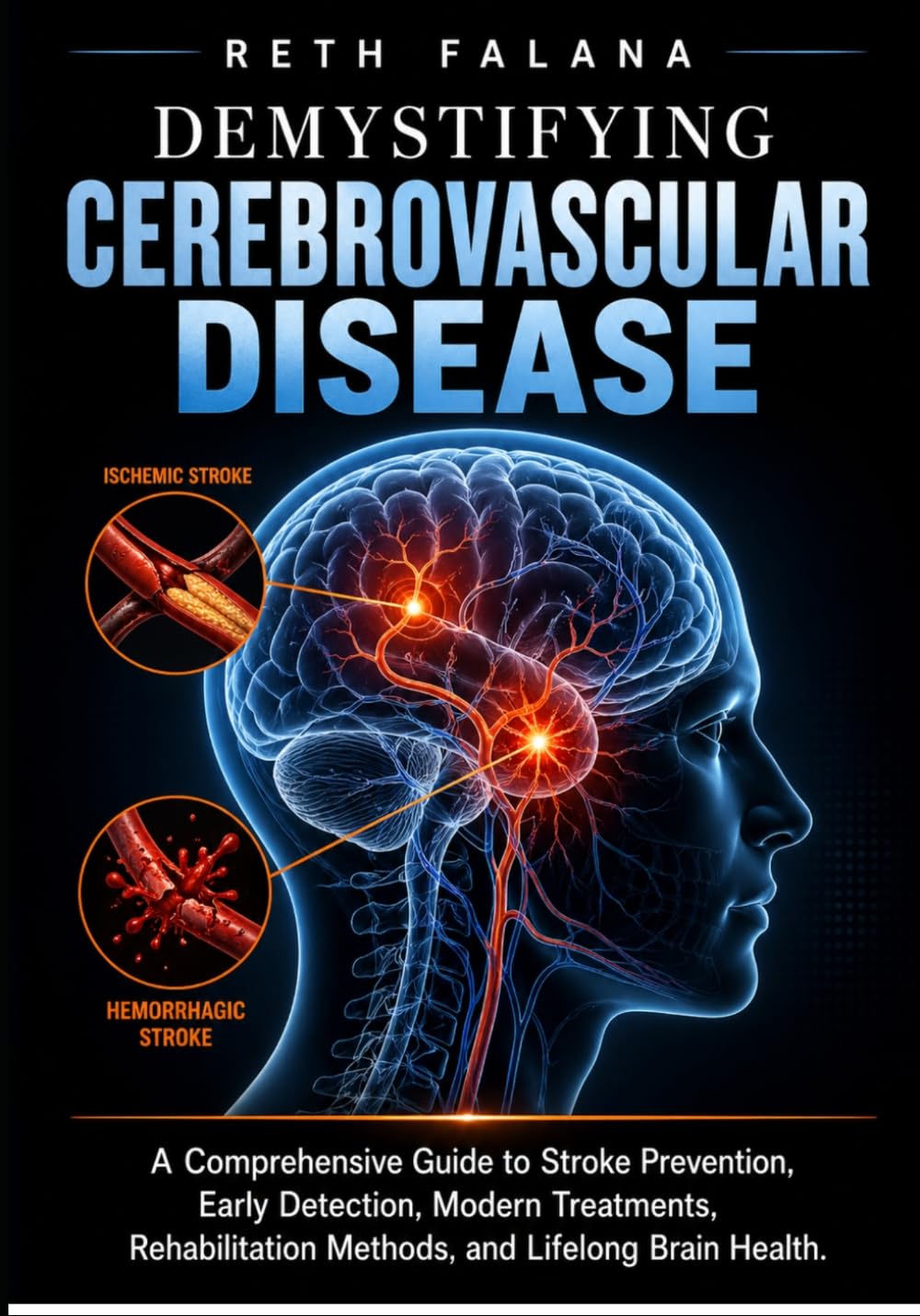 Demystifying Cerebrovascular Disease: A Comprehensive Guide to Stroke Prevention, Early Detection, Modern Treatments, Rehabilitation Methods, and ... Health and Chronic Disease Management Series)