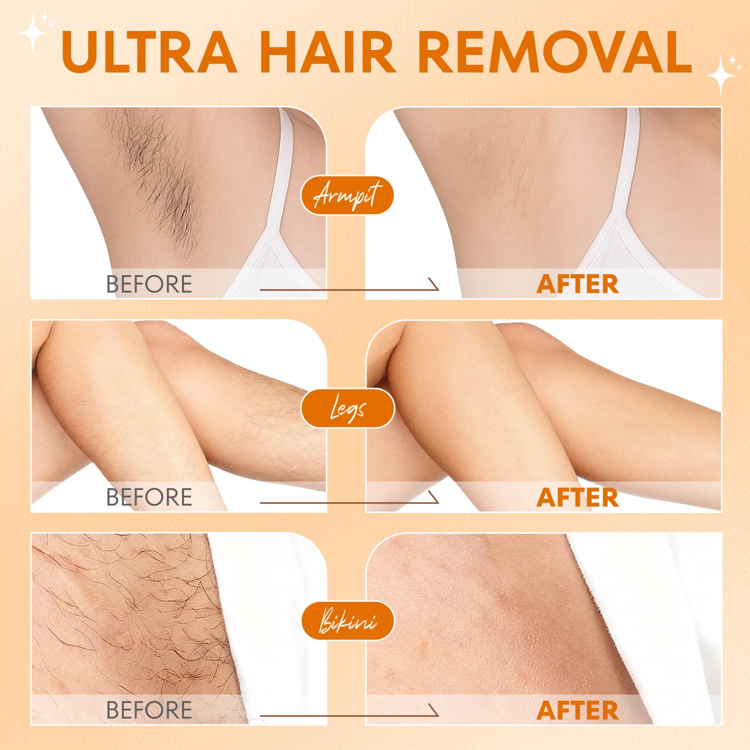 VG VOGCREST Bikini Trimmer für Frauen - 2-in-1 schmerzloser Körperrasierer für Achselbein Arm (Champagner Gold)