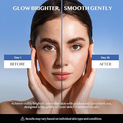 Miniatura 4 de Removedor de manchas oscuras para cara y cuerpo eliminador de manchas oscuras, melasma, pecas, manchas solares, fórmula avanzada con niacinamida