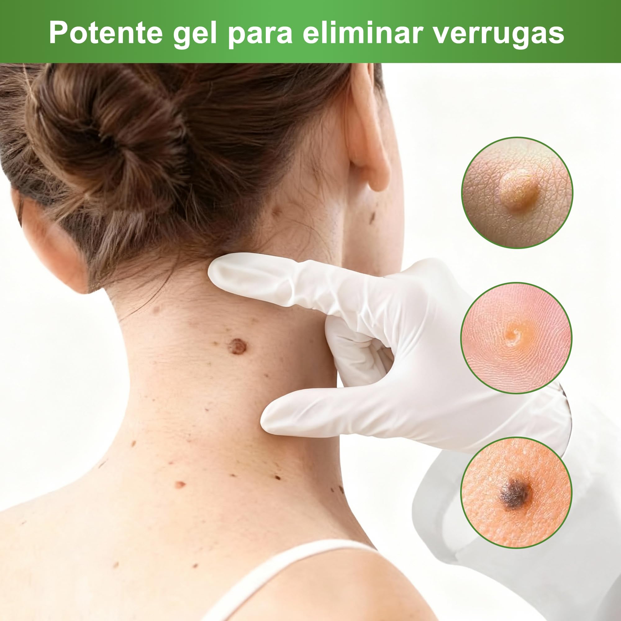 Gel para Quita Verrugas (Quita Verrugas)