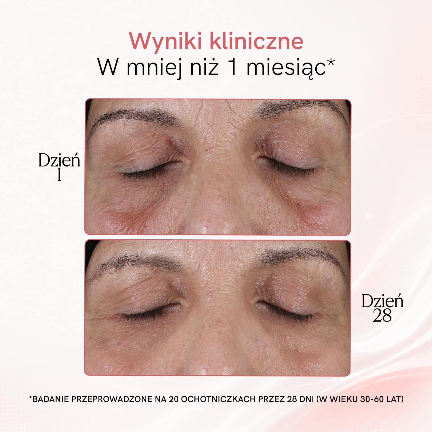 MASDERM | Urządzenie o częstotliwości radiowej 7 w 1 | Elektryczne urządzenie do masażu twarzy | Wiotczenie twarzy | Profesjonalna maszyna Hifu do twarzy i ciała | Wysoka częstotliwość Estetyczna |