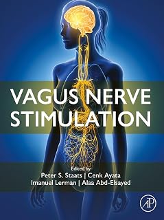 Vagus Nerve Stimulation