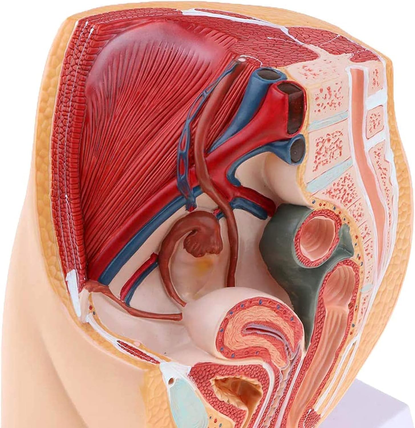 Model Anatomiczny Miednicy żeńskiej, Przekrój Strzałkowy Pośrodkowy, Ginekologiczne Zapalenie Gruczołu Krokowego Z Więzadłami, Naczyniami, Nerwami, Dnem Miednicy I Narządami, Do Szkoleń Med