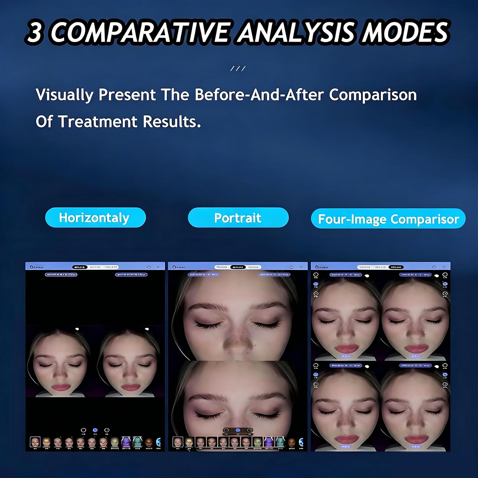 Instrumento de Análisis Facial con Análisis de Síntomas, Analizador de Piel con Pantalla Táctil de 15,6", Análisis y Predicción de Síntomas Cutáneos, 17 Parámetros de Prueba, 36 Megapíxeles