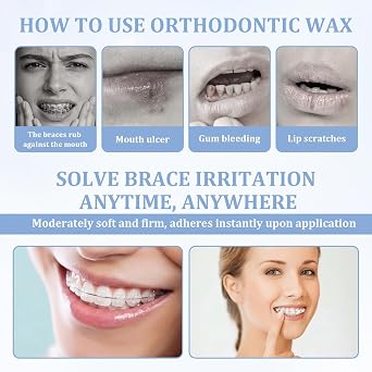 10 Boxs Orthodontic Wax,Portable Dental Wax for Braces Wearers Gum Protection,Easy-To-Apply Strips for Brackets & Wires