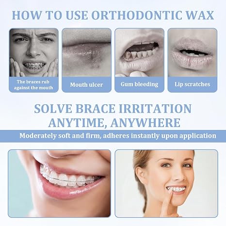 10 Boxs Orthodontic Wax,Portable Dental Wax for Braces Wearers Gum Protection,Easy-To-Apply Strips for Brackets & Wires