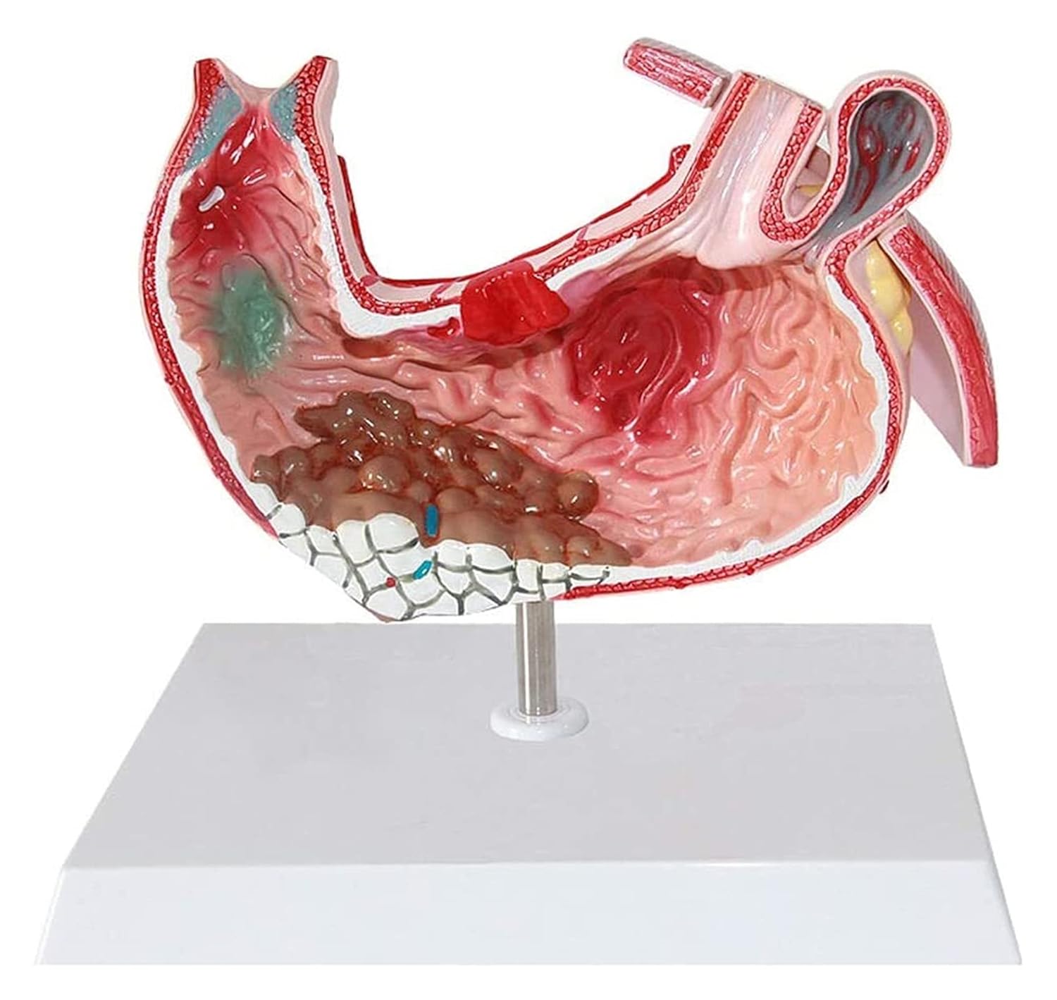 Anatomical Model, Human Organ Anatomical Anatomy Model Human Stomach