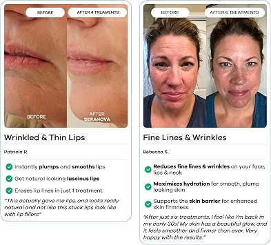 Sera - nova Micro Infusion System for Face – 0.05mm Derma Stamp with Collagen Peptide Serum | At-Home Microneedling Kit for Fine Lines, Hydration & Radiance | Micro Needling Serum 1-Month Supply