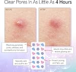 grace & stella Award Winning Hydrocolloid Skin Rescue Covers with Mirror Case - With Salicylic Acid and Tea Tree for Absorbing Impurities - Dermatologist Tested Vegan Skin Care (Multishape, 72 Pack)