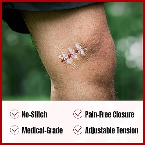 Miniatura 3 de RHINO RESCUE Kit de cierre de heridas, 3 tipos de vendajes de mariposa con vendajes, ungüento antibiótico triple, tiras de cierre de heridas, sin