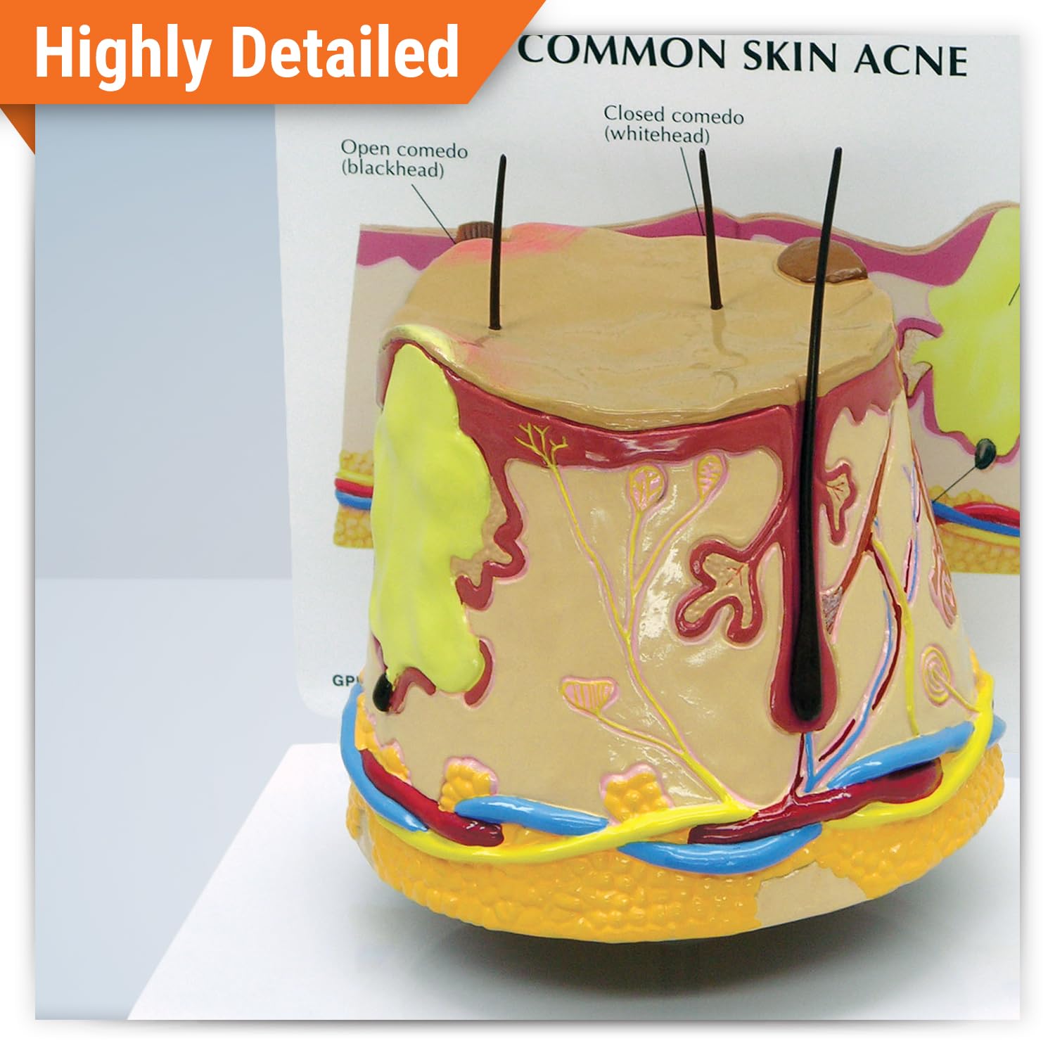 GPI Anatomicals - Skin Acne Model, Cylindrical Model Showing Normal and Common Acne-Riddled Skin for Human Anatomy, Physiology Education, Anatomy Model for Doctor's Office, Medical Learning Resources