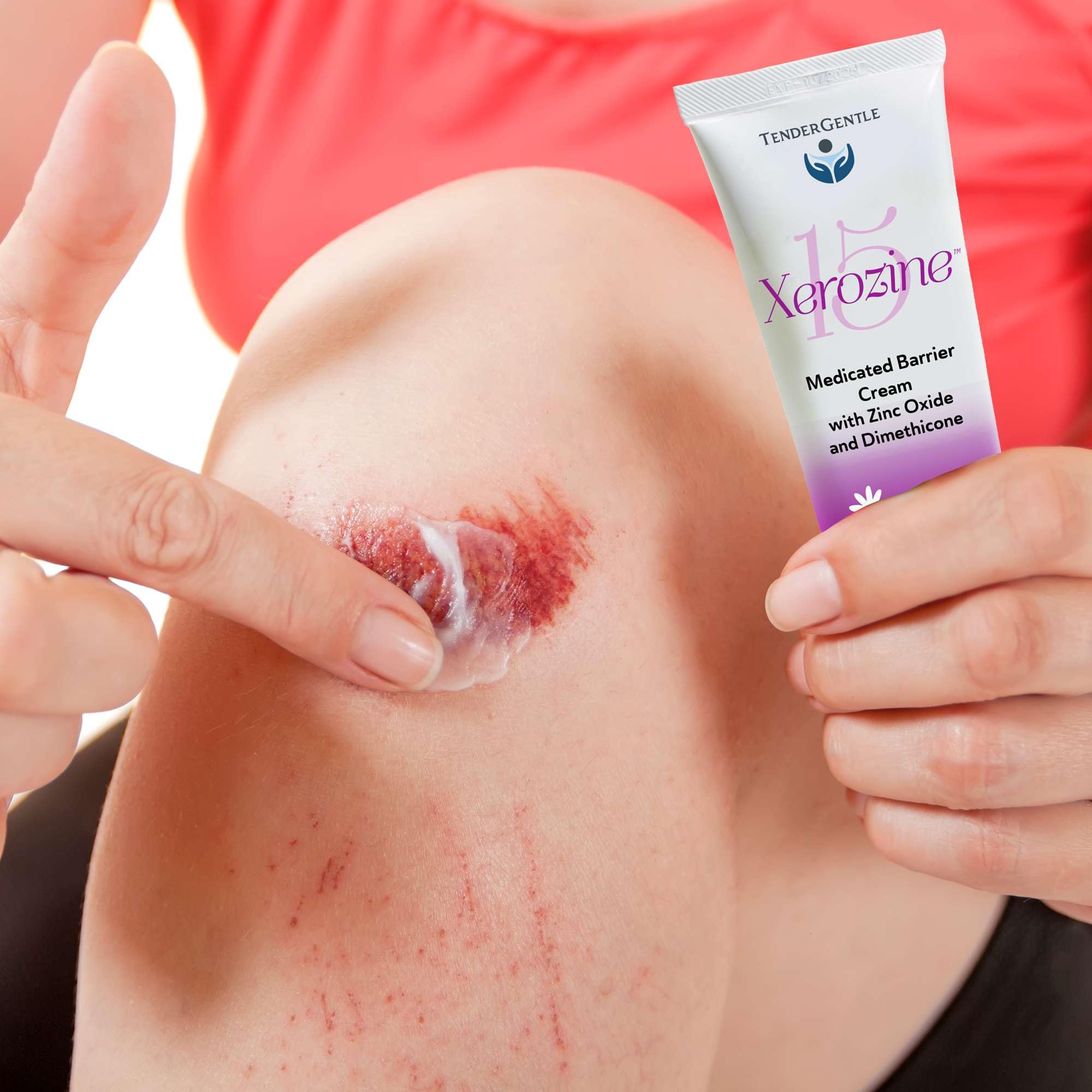 Amazon.com: Zinc and Dimethicone Cream, 4oz - Medicated Barrier