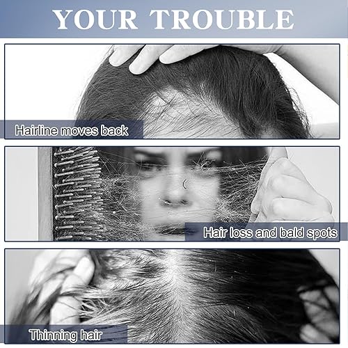 Miniatura 5 de 5% Minoxidil Spray para el crecimiento del cabello para mujeres y hombres tratamiento anti pérdida de cabello para el crecimiento del cabello