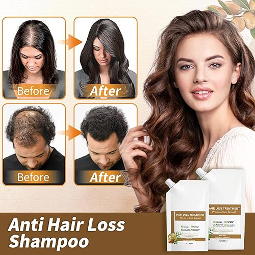 Miniatura 4 de Champú anticaída contra la caída del cabello - Champú para promover el crecimiento del cabello, rico en varios extractos de plantas, anticaídas que