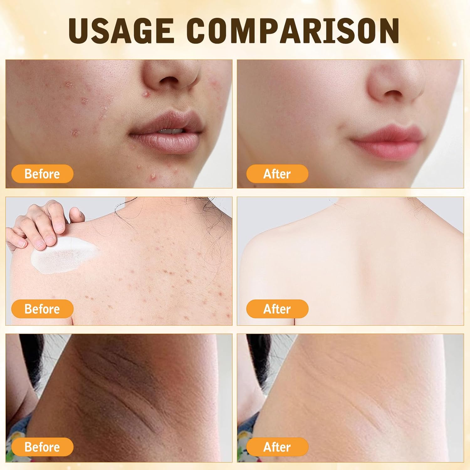 2PCS Bee Venom Comprehensive Cream, Bee Venom Skin Treatment Cream,Deeply Nourishes, Natural Skin Moisturizer for All Skin Type - Image 6