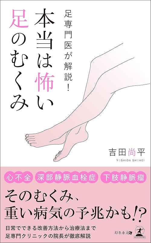 足専門医が解説！ 本当は怖い足のむくみ