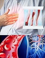 Vista 4 de Medarchitect Modelo de vaso sanguíneo LDL de la lipoproteína de baja densidad para la enseñanza del médico del paciente médico