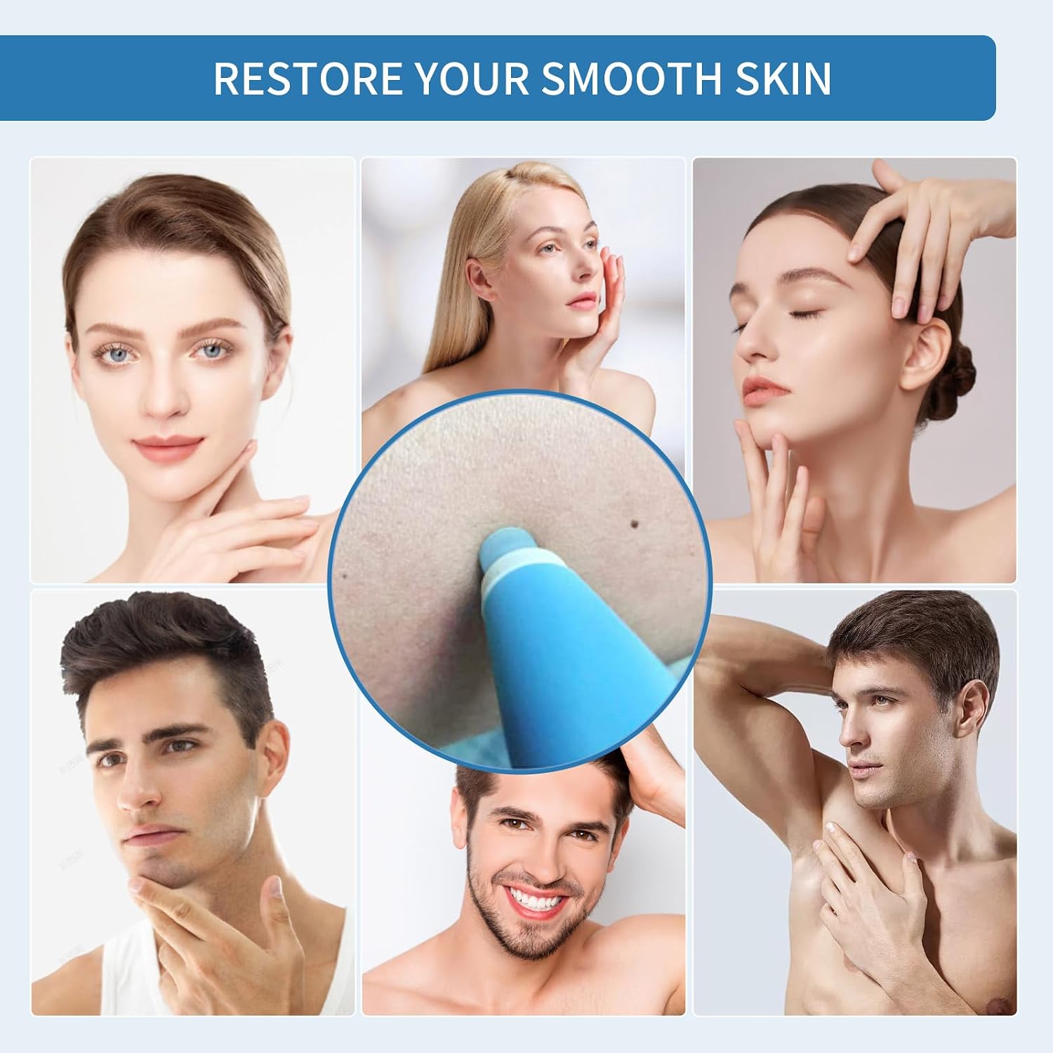Dual-TROL Skin Removal Kit, Intended for The Treatment On Adult to Be Used At Home