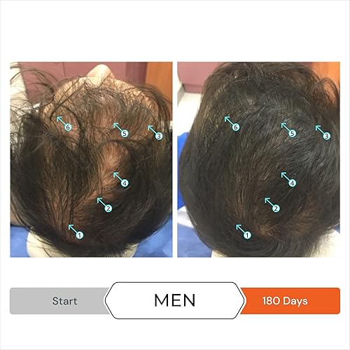 Miniatura 4 de DS Laboratories Revita - Juego de champú y acondicionador y tabletas Revita, champú y acondicionador para engrosar el cabello y vitaminas para el