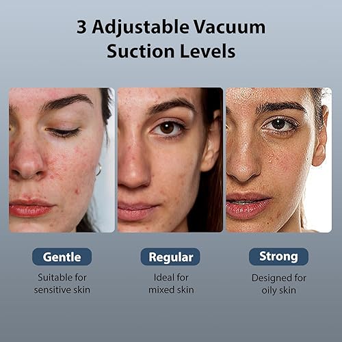 Miniatura 4 de Hydrapore - Aspiradora de poros para eliminar puntos negros, 5 en 1, con compresa fría y caliente, extractor de puntos negros con 2 ventosas y 3