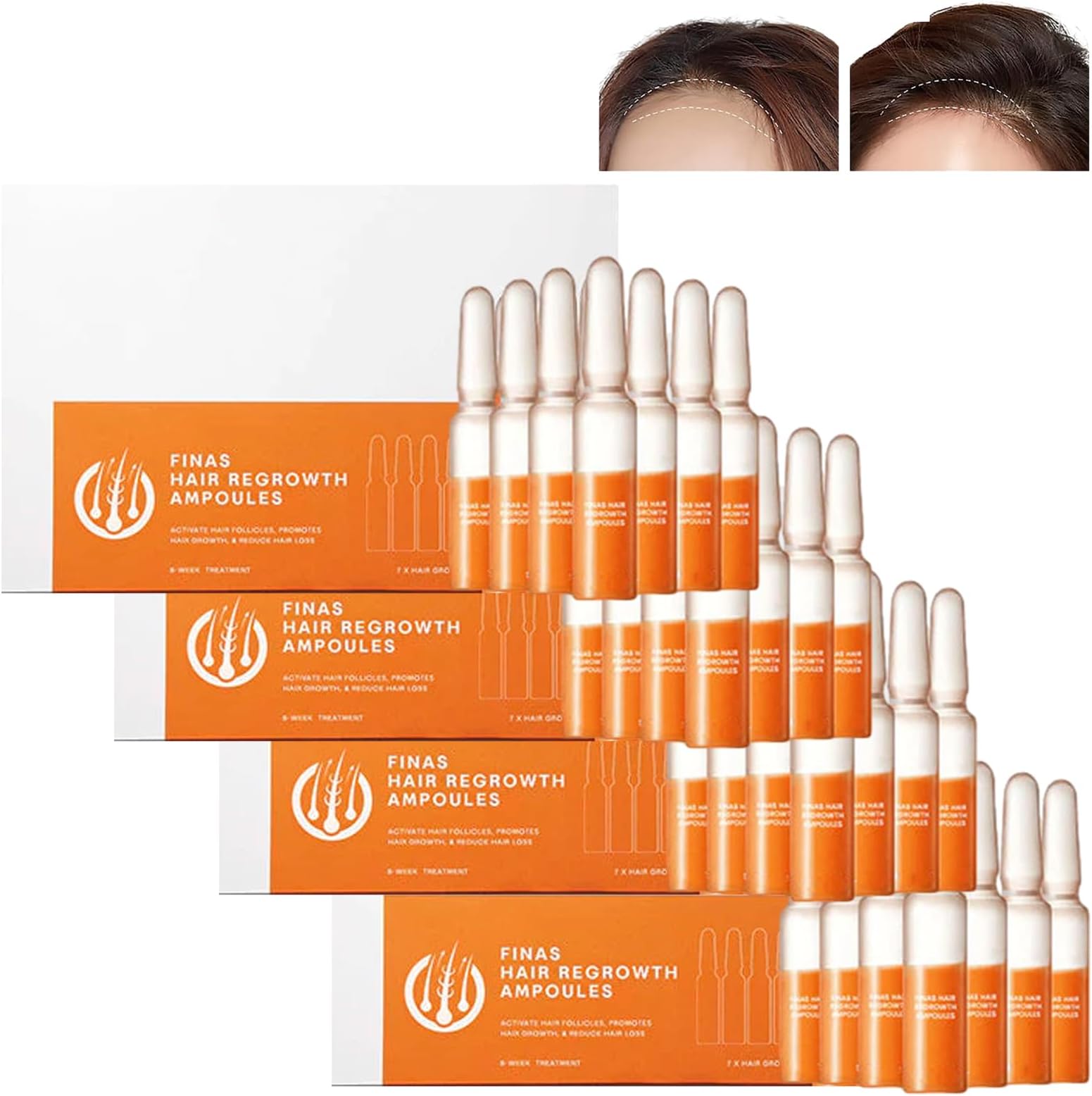 Liasc FINAS Prestig Hair-Regrowth Ampoules,Liasc Hairmuch Hair Growth Ampoule Serum Lotion,Biotin Hair Growth Serum,Hair Loss Thickening Regrowth for Thinning Hair (28 pcs/4 boxes)