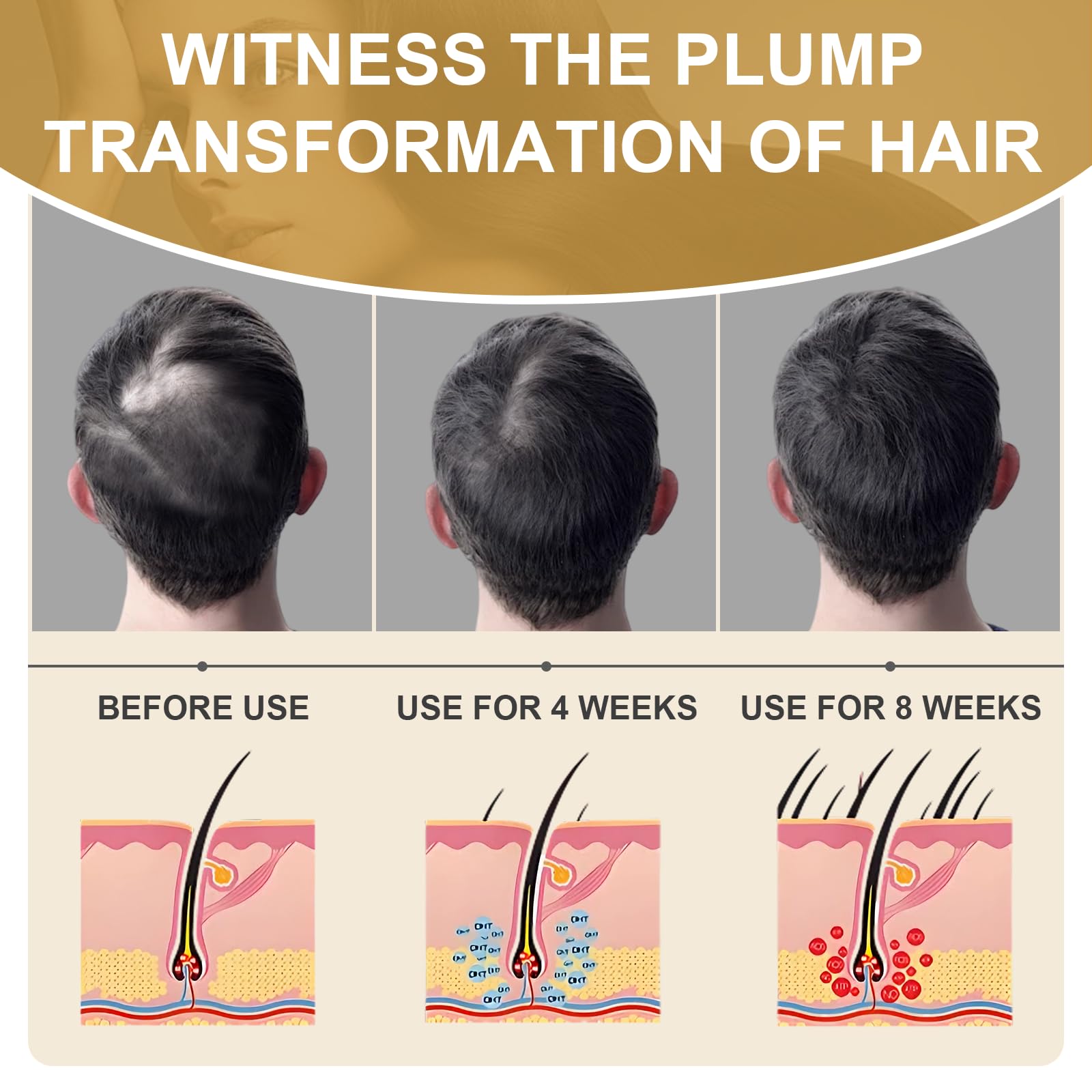 2×30ML Siero Capelli Crescita, Anti-Caduta Dei Capelli Sieri Di Crescita, Promuove una Hair Growth Serum, Rinforza Cuoio Capelluto e Hair, per Uomo e Donna