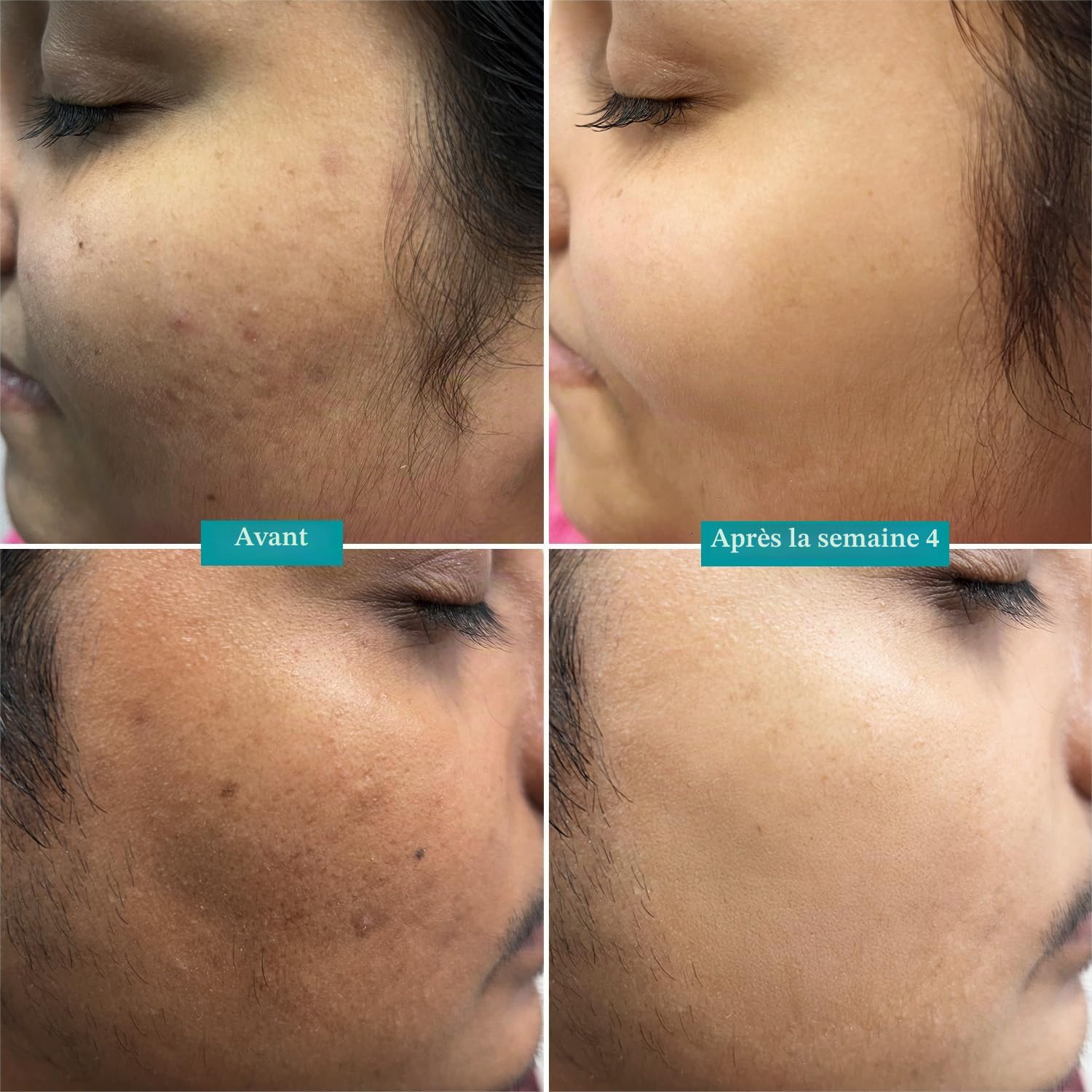 Pilgrim Sérum à 10 % de vitamine C 30 ml pour une peau éclatante | Avec 5 % de niacinamide, acide hyaluronique et glycolique | estompe les taches brunes, la pigmentation | Pour tous, peaux grasses