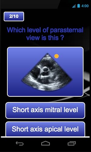 Echocardiography cases
