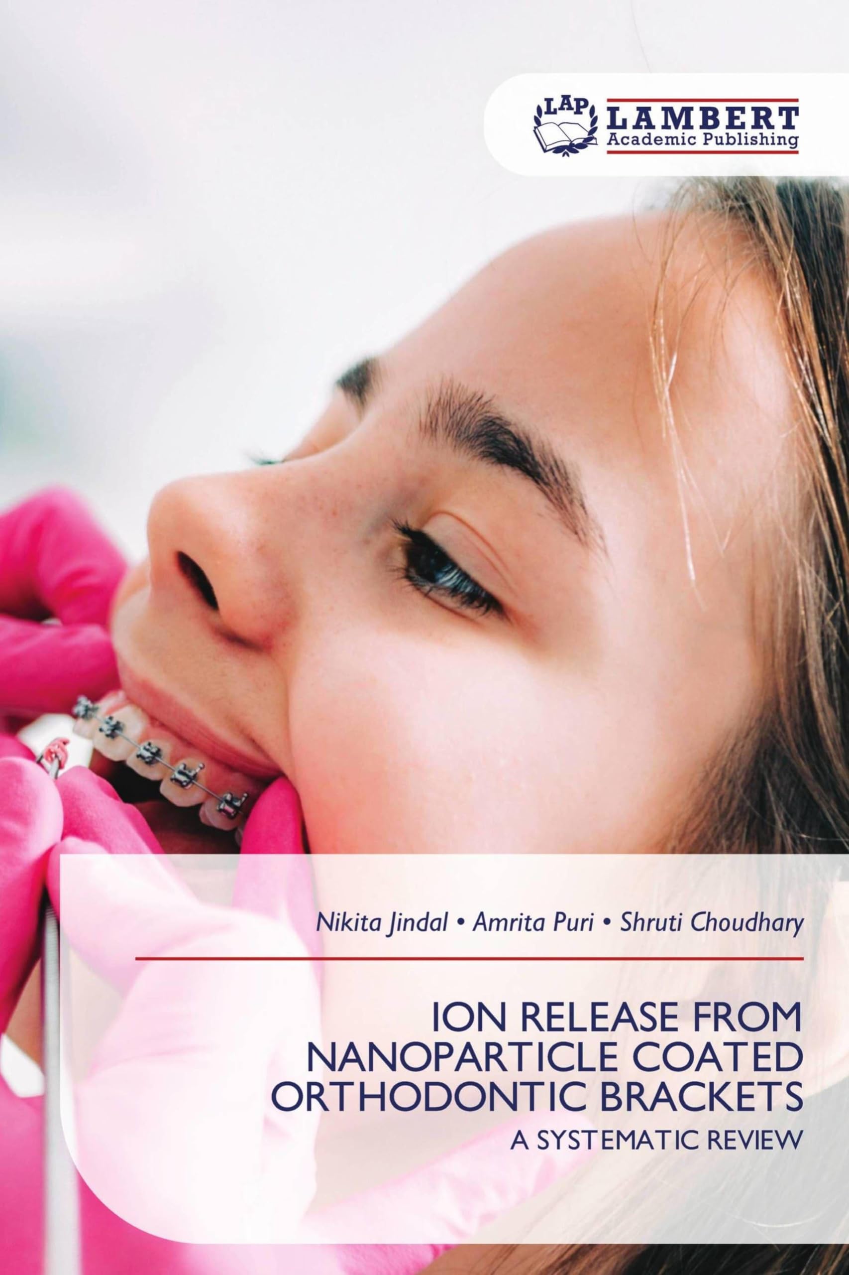 Ion Release from Nanoparticle Coated Orthodontic Brackets: A SYSTEMATIC REVIEW