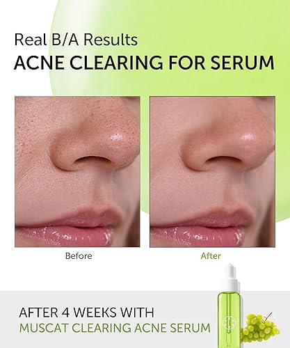 Vista 10 de SERUMKIND Black Tulip Serum - Suero facial coreano antioxidante de reparación de barrera, beta glucano, hidratante y antienvejecimiento, vegano, sin