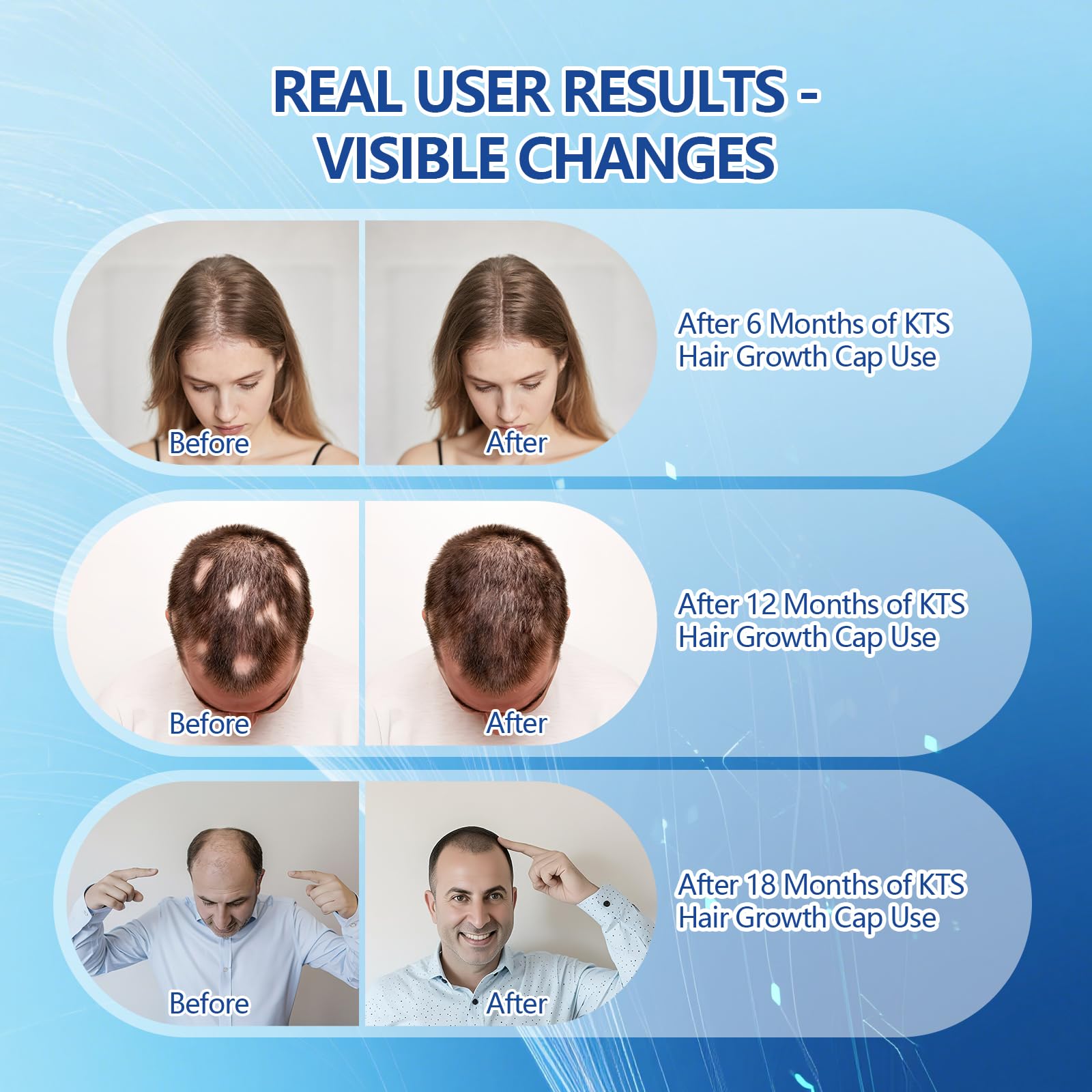 KTS LED Haarwachstum Kappe,620nm Rotlicht&460nm Blaulicht Duales Lichtspektrum,Hair Growth Cap für Frauen/Männer,Abnehmbarer Silikon-Innenkappe,Komfortable Haarpflege für Zuhause