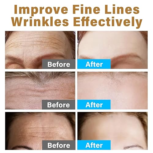 Miniatura 6 de Yakitoko Parches antiarrugas para la frente, parches antiarrugas para la frente, alisan eficazmente líneas finas y arrugas con colágeno hidrolizado